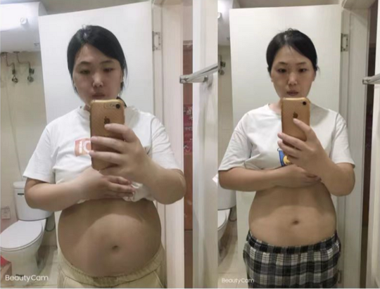 生完二胎后的我体重增加到了140多斤