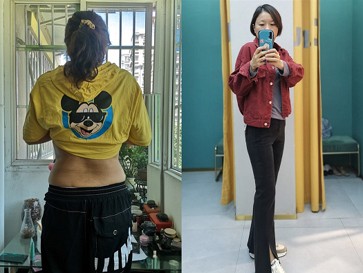 体重甚至一度涨到142斤,产后肥胖-很多宝妈的会经历