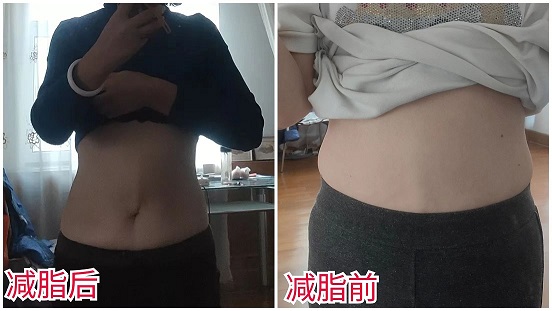 45岁开始节食运动减肥,恢复正常的饮食就快速反弹